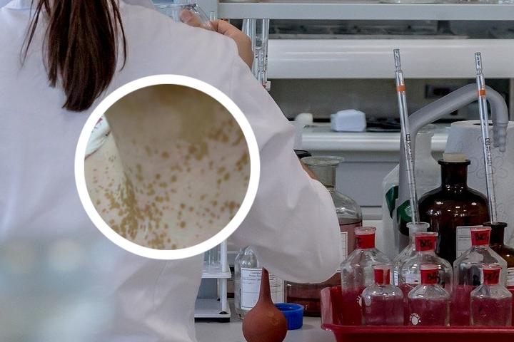 新生儿白癜风多久能治好