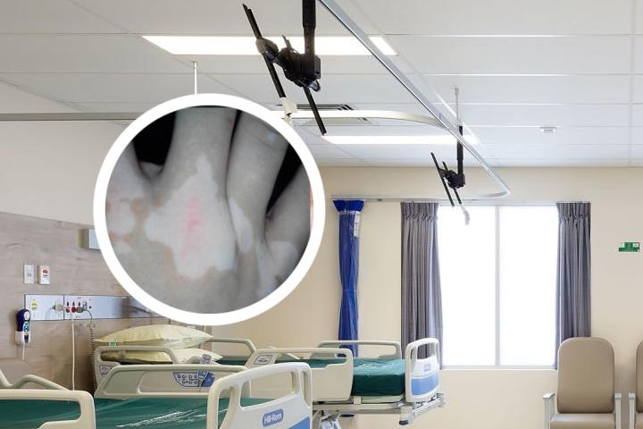 南京看白癜风病哪家医院好