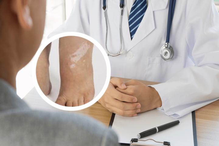 白癜风危害生命嘛 白癜风危害健康么