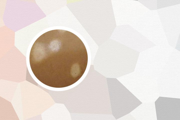 手上长小白点是白癜风吗