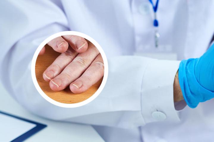 白癜风病是否遗传后代