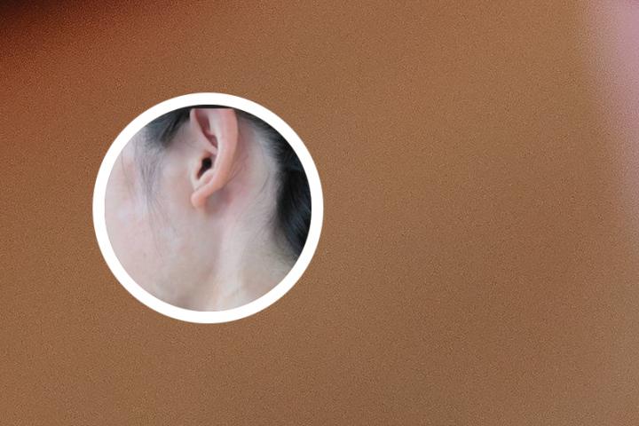 白癜风能吃炒白术吗