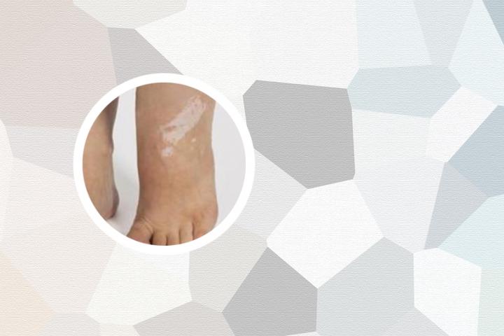 北京白癜风病医院排名