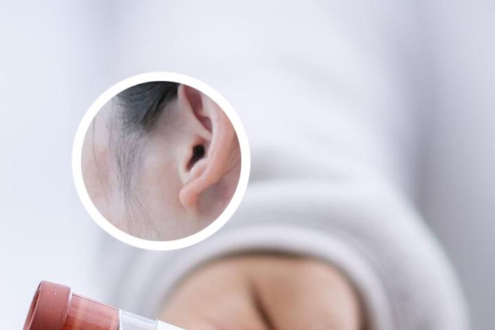 沈阳治白癜风青睐中科