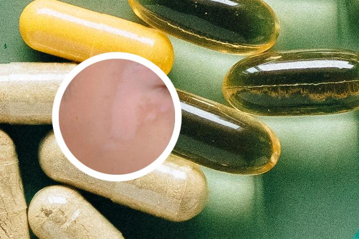 天水有什么医院治白癜风