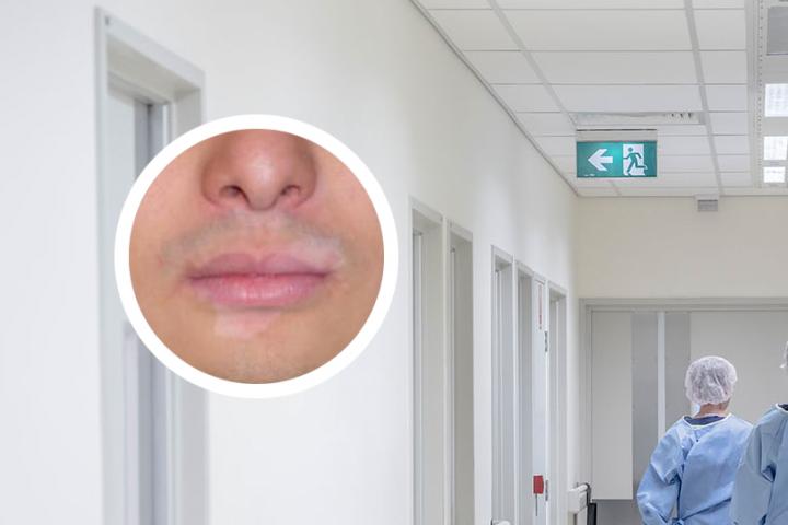 白癜风头部白发能变黑吗