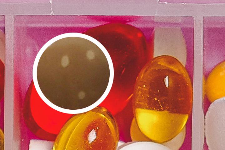 深圳白癜风纳入医保报销吗