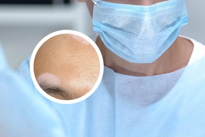 白癜风光疗仪器真的有用吗
