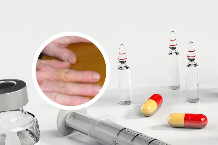 妈妈有白癜风遗传孩子吗