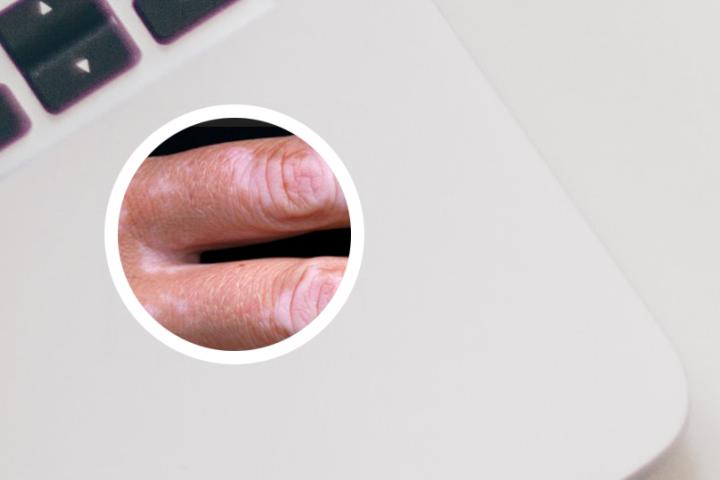 白癜风患者日常注意什么