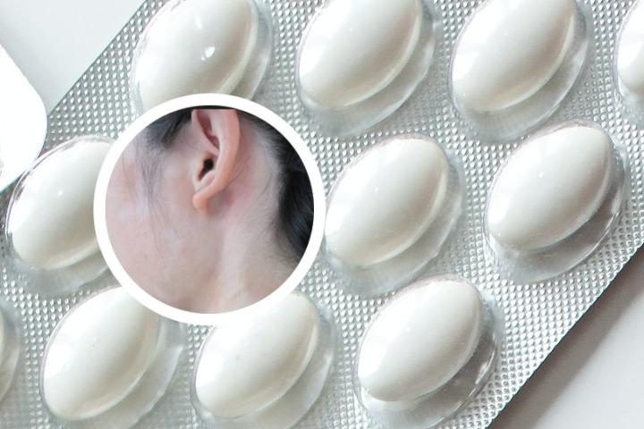 舟山哪里可以看白癜风