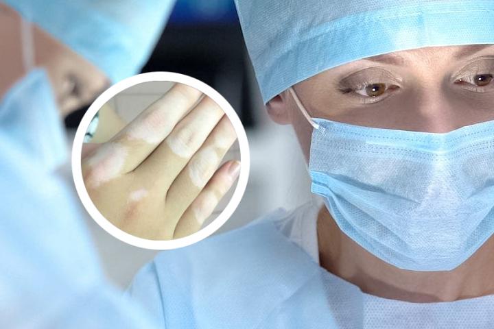白癜风的扩散率