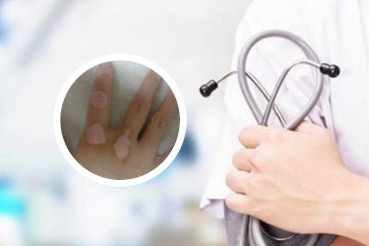 白癜风患者能吃干竹笋吗
