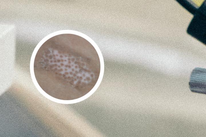 白癜风初期上西安好