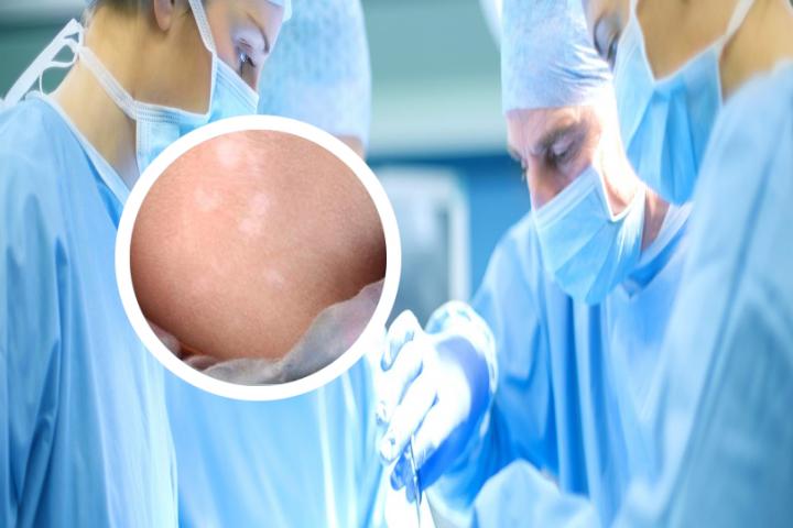 白癜风治疗用药大全