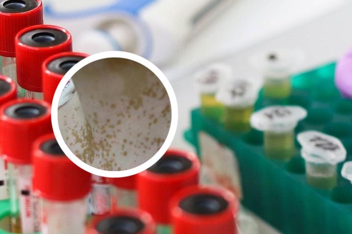 白癜风症如何治疗
