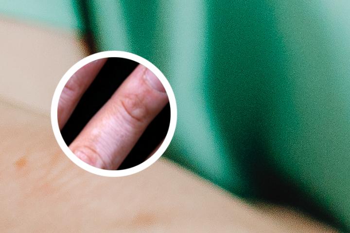 白斑和白癜风一样么