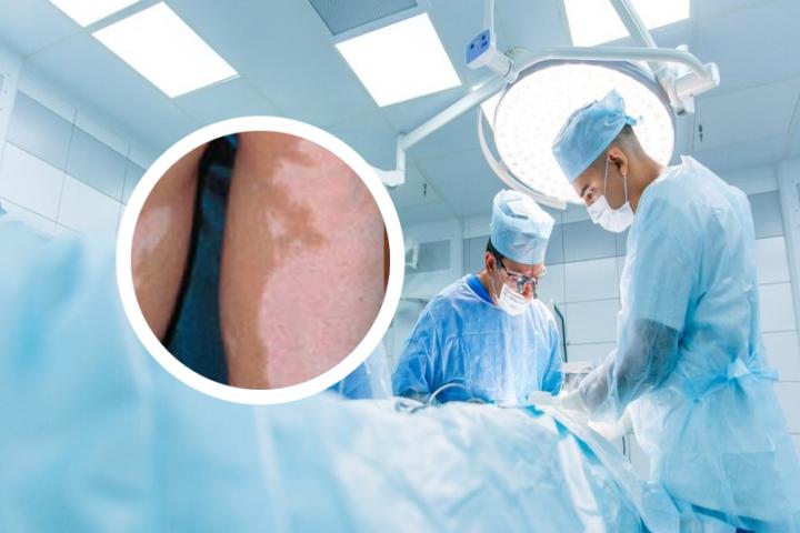 沈阳哪个医院治白癜风最好