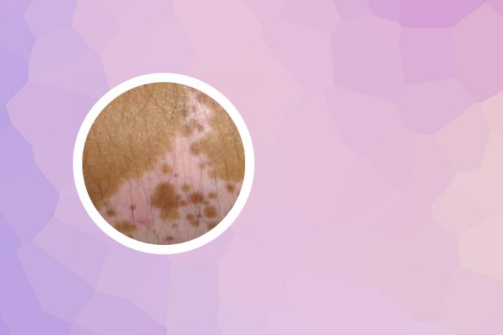专治白癜风的门诊