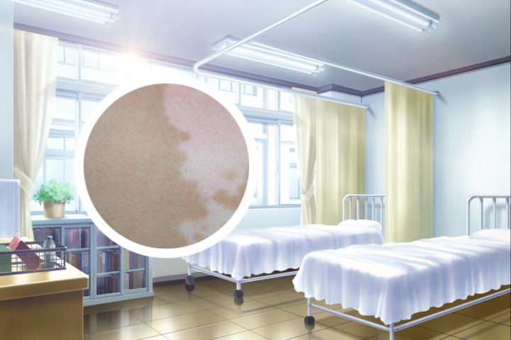 晓晓尊师白癜风
