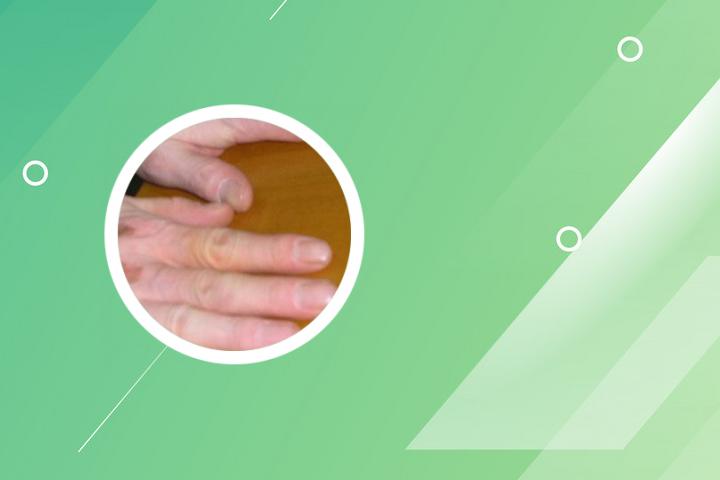 用白醋可以治白癜风吗