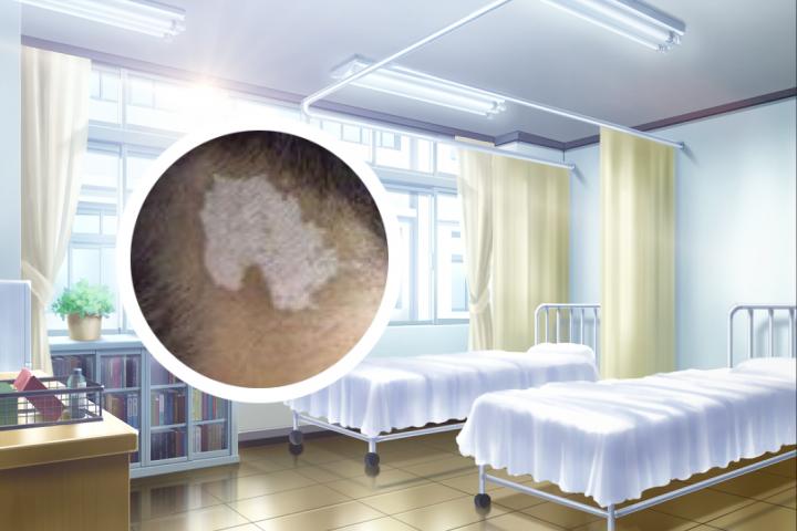 白癜风宣传单