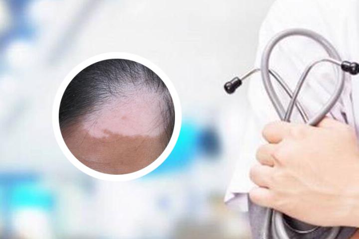 重庆哪家大医院看白癜风