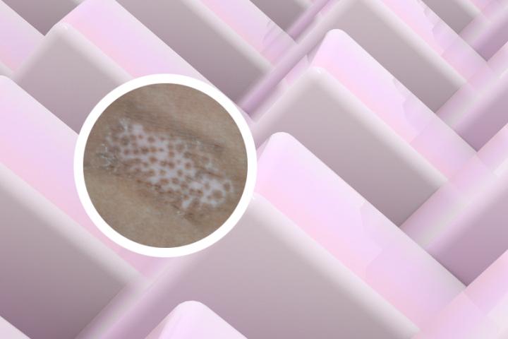 白癜风的孩子需要吃些什么