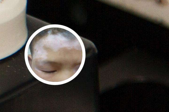 白癜风可以吃羊血么