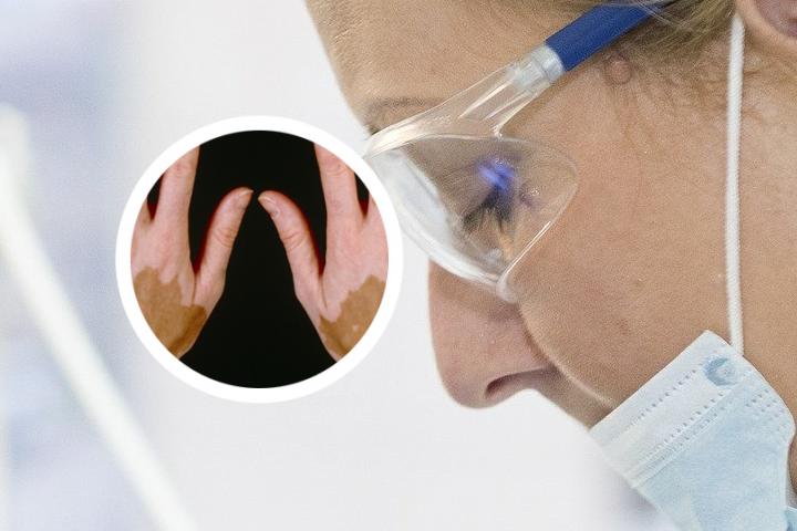深圳哪个白癜风医院更好