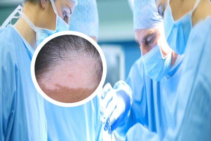 白癜风传染不